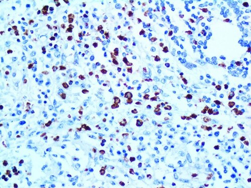 IHC of TIA-1 on an FFPE Tonsil Tissue